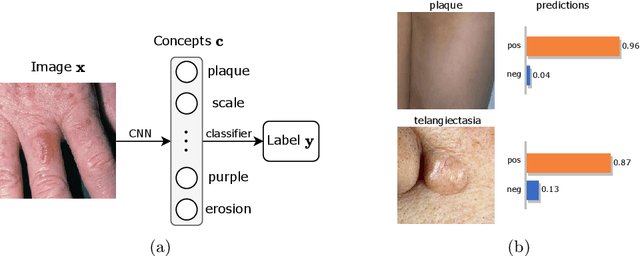 Figure 1 for Evidential Concept Embedding Models: Towards Reliable Concept Explanations for Skin Disease Diagnosis