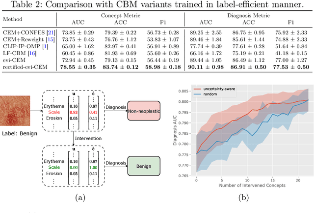 Figure 4 for Evidential Concept Embedding Models: Towards Reliable Concept Explanations for Skin Disease Diagnosis