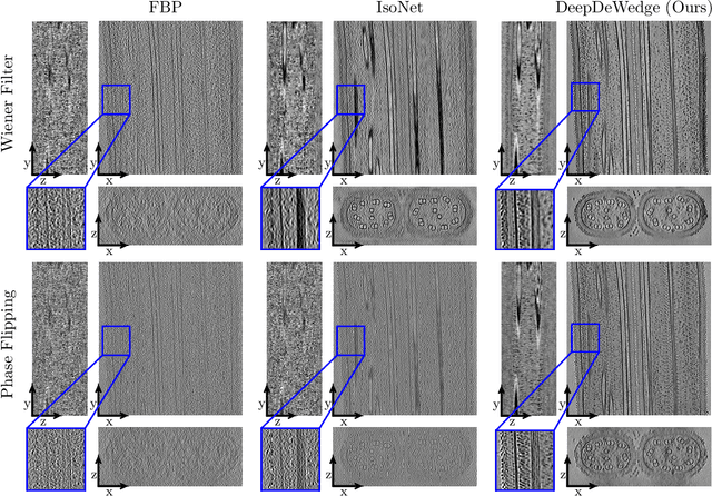 Figure 4 for A Deep Learning Method for Simultaneous Denoising and Missing Wedge Reconstruction in Cryogenic Electron Tomography