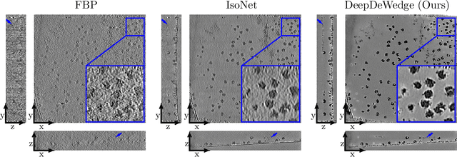 Figure 3 for A Deep Learning Method for Simultaneous Denoising and Missing Wedge Reconstruction in Cryogenic Electron Tomography