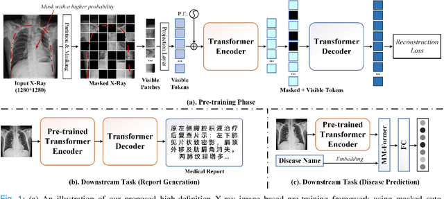 Figure 1 for Pre-training on High Definition X-ray Images: An Experimental Study