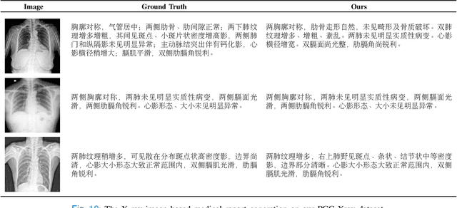 Figure 2 for Pre-training on High Definition X-ray Images: An Experimental Study