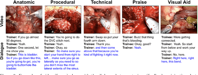 Figure 3 for Deep Multimodal Fusion for Surgical Feedback Classification