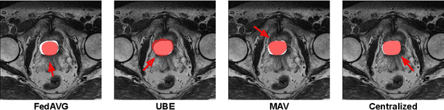 Figure 2 for Benchmarking Collaborative Learning Methods Cost-Effectiveness for Prostate Segmentation