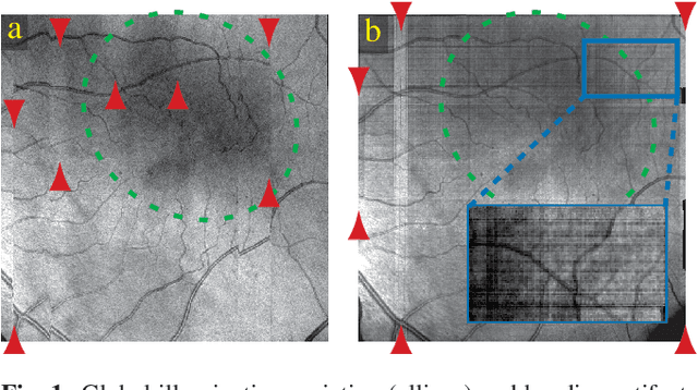 Figure 1 for A Spatiotemporal Illumination Model for 3D Image Fusion in Optical Coherence Tomography