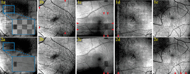 Figure 4 for A Spatiotemporal Illumination Model for 3D Image Fusion in Optical Coherence Tomography