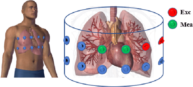 Figure 1 for Spatio-Temporal Classification of Lung Ventilation Patterns using 3D EIT Images: A General Approach for Individualized Lung Function Evaluation