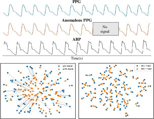 Figure 1 for Constraint Latent Space Matters: An Anti-anomalous Waveform Transformation Solution from Photoplethysmography to Arterial Blood Pressure