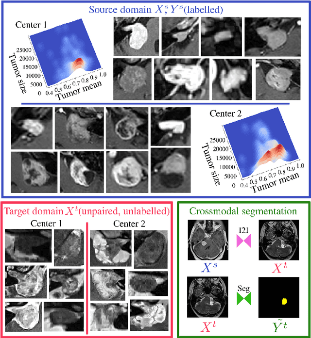 Figure 1 for Cross-modal tumor segmentation using generative blending augmentation and self training