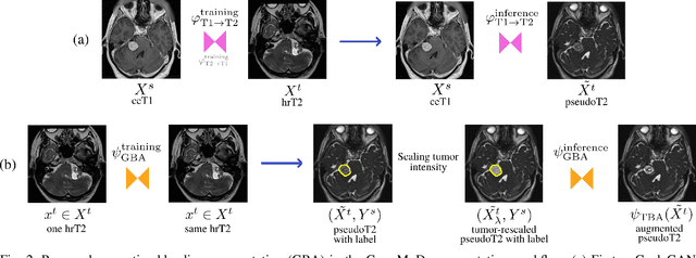 Figure 2 for Cross-modal tumor segmentation using generative blending augmentation and self training