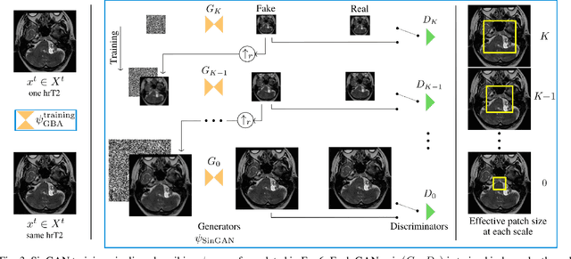 Figure 3 for Cross-modal tumor segmentation using generative blending augmentation and self training
