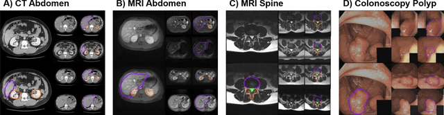 Figure 4 for RadImageGAN -- A Multi-modal Dataset-Scale Generative AI for Medical Imaging