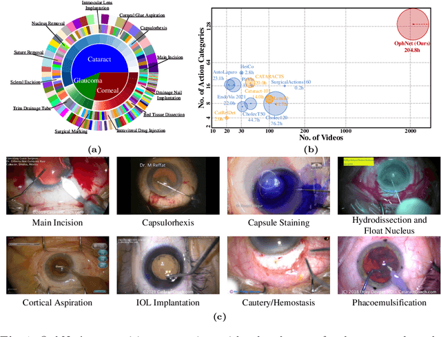 Figure 2 for OphNet: A Large-Scale Video Benchmark for Ophthalmic Surgical Workflow Understanding