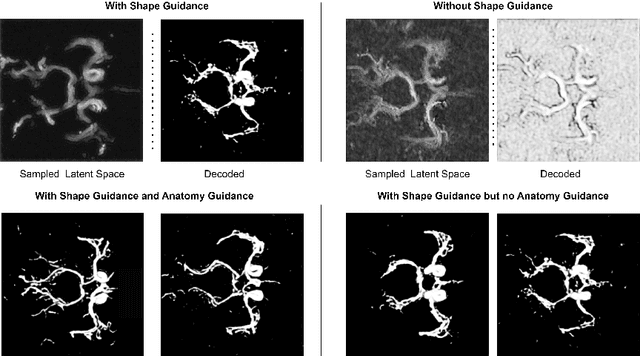 Figure 3 for Shape-guided Conditional Latent Diffusion Models for Synthesising Brain Vasculature