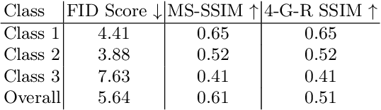 Figure 4 for Shape-guided Conditional Latent Diffusion Models for Synthesising Brain Vasculature