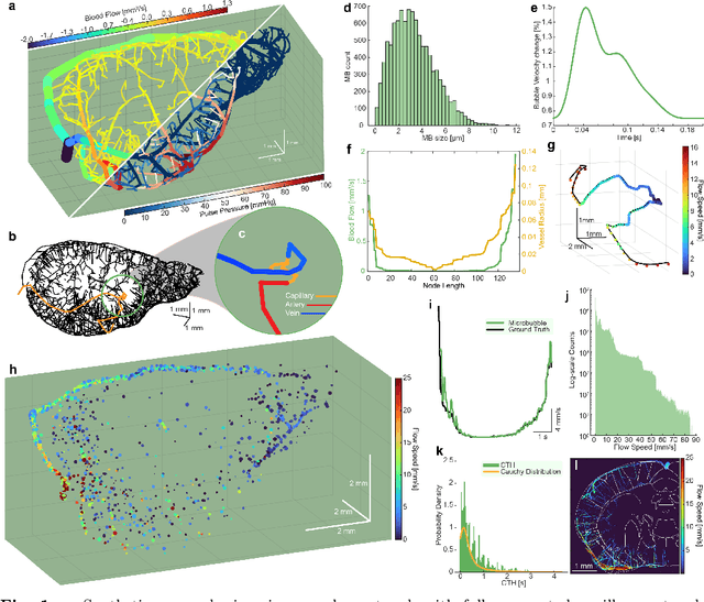 Figure 1 for Functional Assessment of Cerebral Capillaries using Single Capillary Reporters in Ultrasound Localization Microscopy