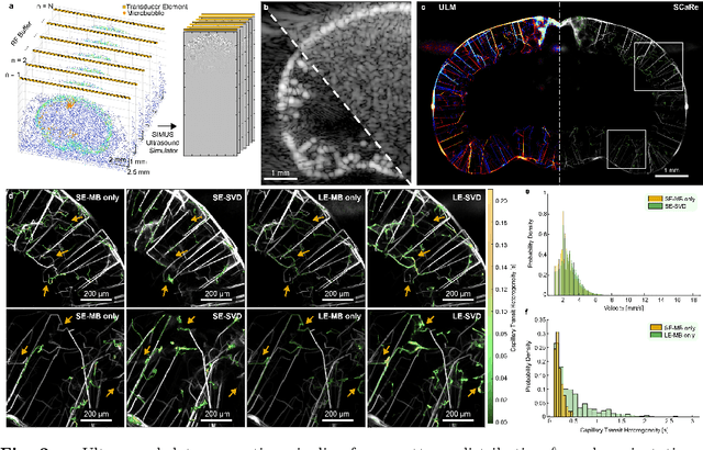 Figure 2 for Functional Assessment of Cerebral Capillaries using Single Capillary Reporters in Ultrasound Localization Microscopy