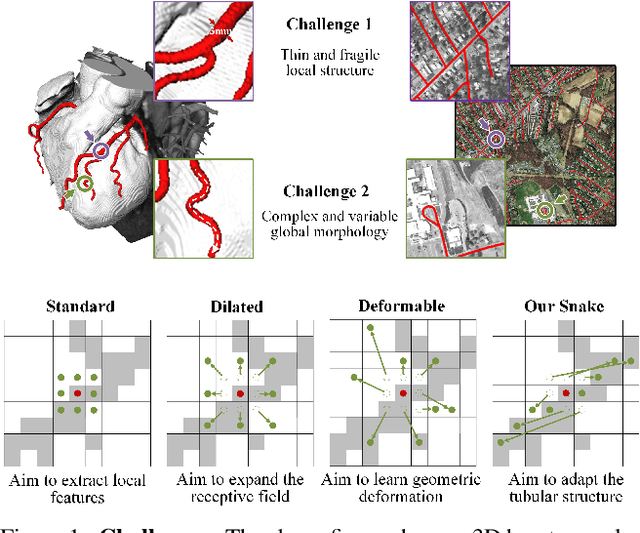 Figure 1 for Dynamic Snake Convolution based on Topological Geometric Constraints for Tubular Structure Segmentation