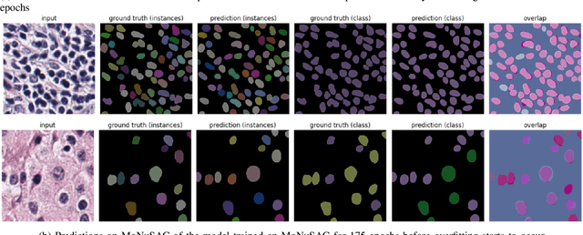 Figure 2 for Combining Datasets with Different Label Sets for Improved Nucleus Segmentation and Classification