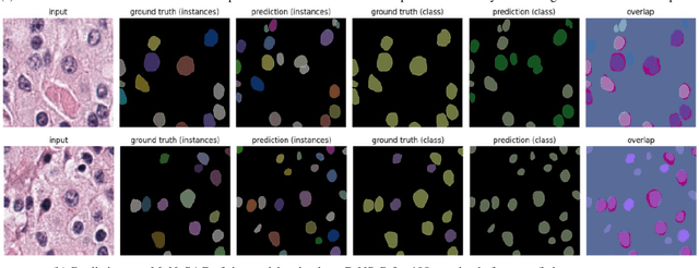 Figure 4 for Combining Datasets with Different Label Sets for Improved Nucleus Segmentation and Classification