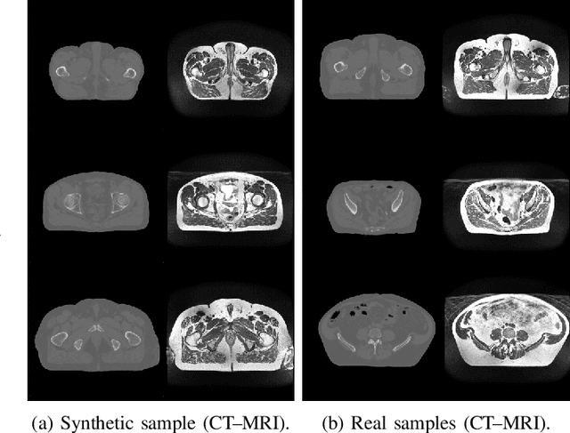 Figure 3 for LatentAugment: Data Augmentation via Guided Manipulation of GAN's Latent Space