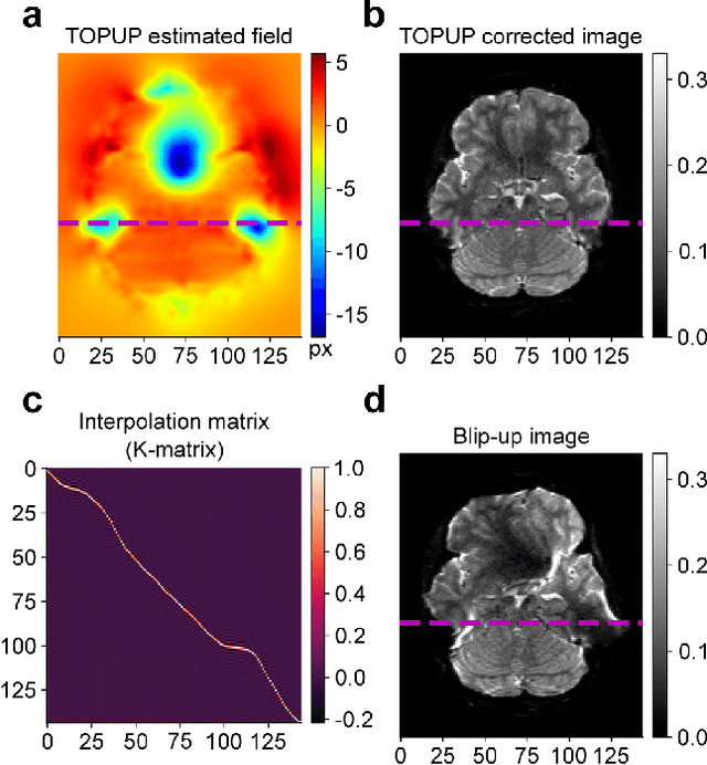 Figure 1 for FD-Net: An Unsupervised Deep Forward-Distortion Model for Susceptibility Artifact Correction in EPI