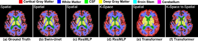 Figure 3 for Domain Influence in MRI Medical Image Segmentation: spatial versus k-space inputs