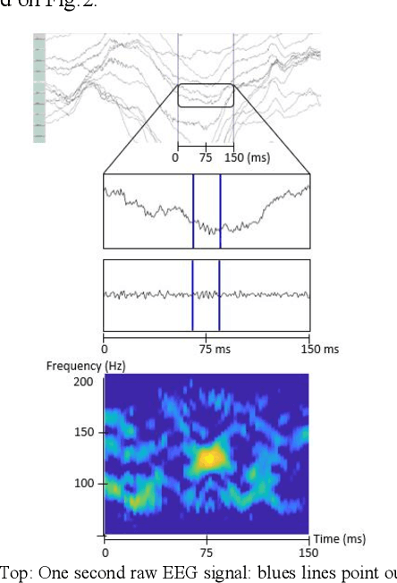 Figure 1 for Deep Learning for scalp High Frequency Oscillations Identification