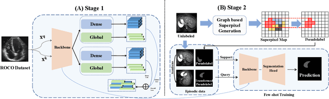 Figure 3 for DenseMP: Unsupervised Dense Pre-training for Few-shot Medical Image Segmentation