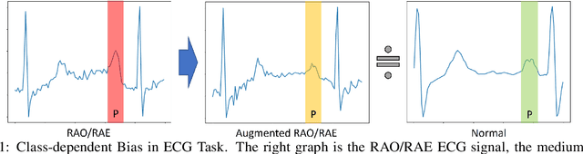 Figure 1 for CAAP: Class-Dependent Automatic Data Augmentation Based On Adaptive Policies For Time Series