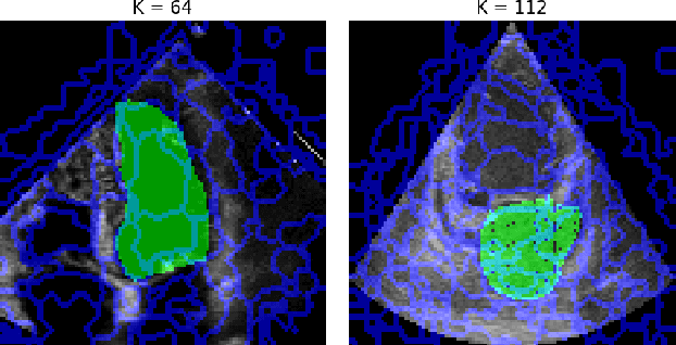 Figure 3 for Unlocking the Heart Using Adaptive Locked Agnostic Networks