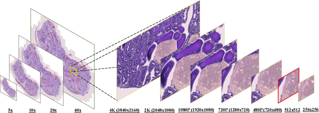 Figure 1 for HoloHisto: End-to-end Gigapixel WSI Segmentation with 4K Resolution Sequential Tokenization