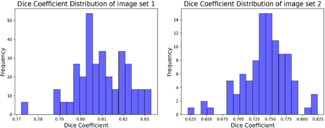 Figure 2 for An unsupervised approach towards promptable defect segmentation in laser-based additive manufacturing by Segment Anything