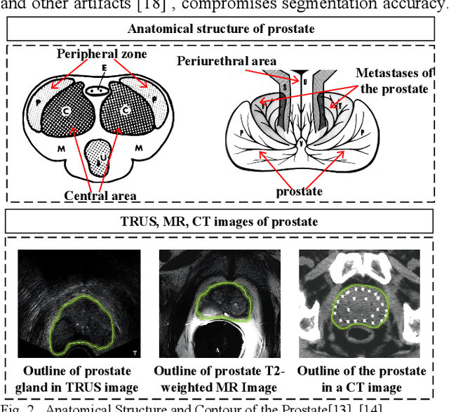 Figure 2 for AI-based Automatic Segmentation of Prostate on Multi-modality Images: A Review