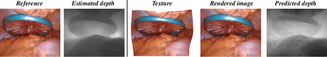 Figure 1 for Endo-4DGS: Endoscopic Monocular Scene Reconstruction with 4D Gaussian Splatting