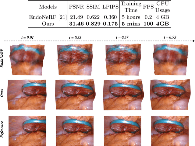 Figure 4 for Endo-4DGS: Endoscopic Monocular Scene Reconstruction with 4D Gaussian Splatting