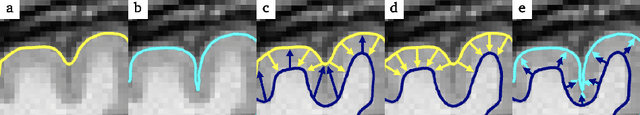 Figure 2 for Weakly Supervised Learning of Cortical Surface Reconstruction from Segmentations