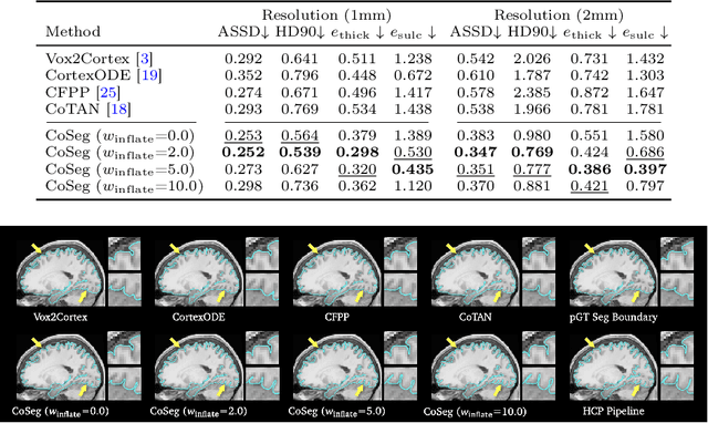 Figure 4 for Weakly Supervised Learning of Cortical Surface Reconstruction from Segmentations