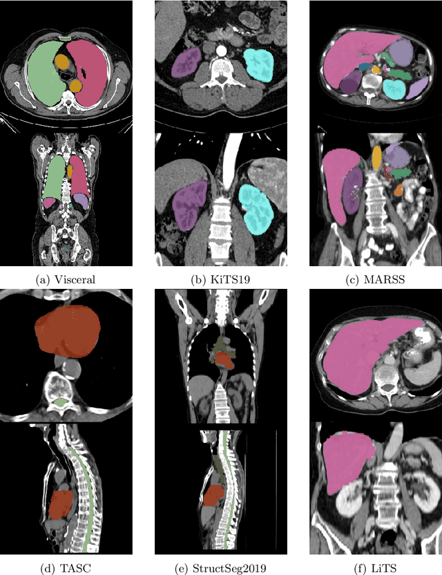 Figure 1 for Transfer learning from a sparsely annotated dataset of 3D medical images