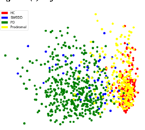 Figure 2 for Analysis, Identification and Prediction of Parkinson's disease sub-types and progression through Machine Learning