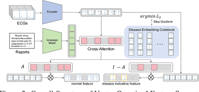 Figure 3 for Personalized Heart Disease Detection via ECG Digital Twin Generation