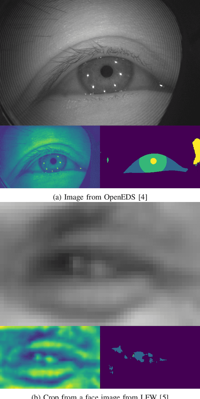 Figure 2 for Robust Sclera Segmentation for Skin-tone Agnostic Face Image Quality Assessment