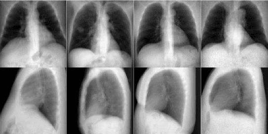 Figure 2 for Transformers for CT Reconstruction From Monoplanar and Biplanar Radiographs