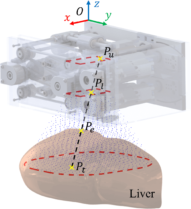 Figure 3 for Body-mounted MR-conditional Robot for Minimally Invasive Liver Intervention