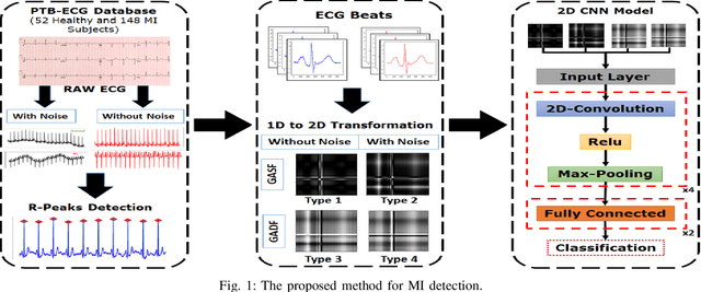 Figure 1 for Myocardial Infarction Detection from ECG: A Gramian Angular Field-based 2D-CNN Approach