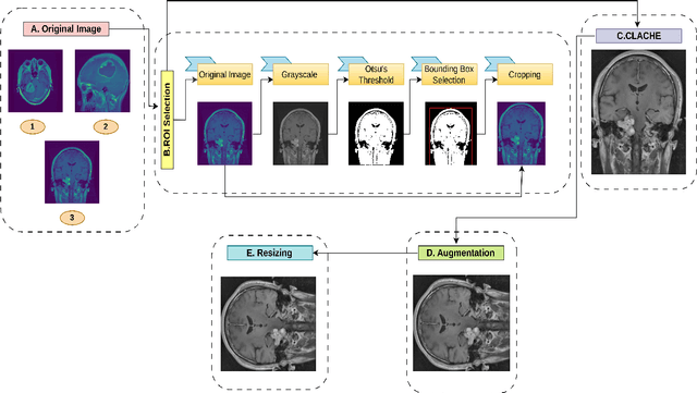 Figure 3 for Deep Fusion Model for Brain Tumor Classification Using Fine-Grained Gradient Preservation