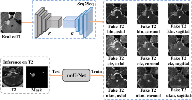 Figure 1 for Fine-Grained Unsupervised Cross-Modality Domain Adaptation for Vestibular Schwannoma Segmentation