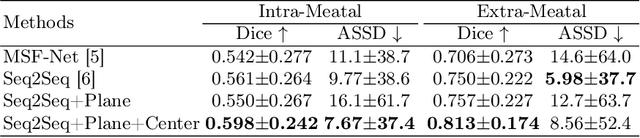 Figure 4 for Fine-Grained Unsupervised Cross-Modality Domain Adaptation for Vestibular Schwannoma Segmentation