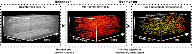 Figure 1 for A Tracking prior to Localization workflow for Ultrasound Localization Microscopy