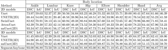 Figure 2 for SegmentAnyBone: A Universal Model that Segments Any Bone at Any Location on MRI